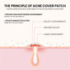 Star Pimple Patches