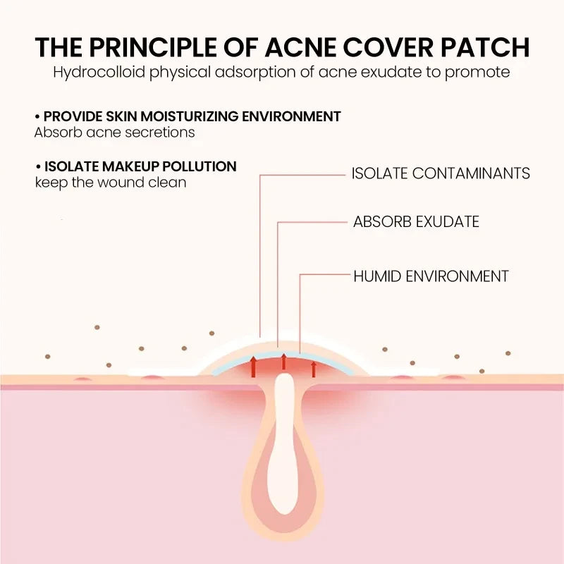 Star Pimple Patches