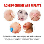 Star Pimple Patches