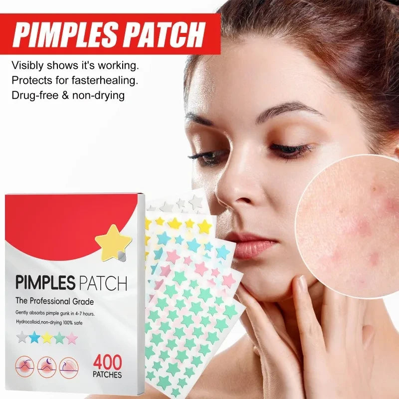 Star Pimple Patches